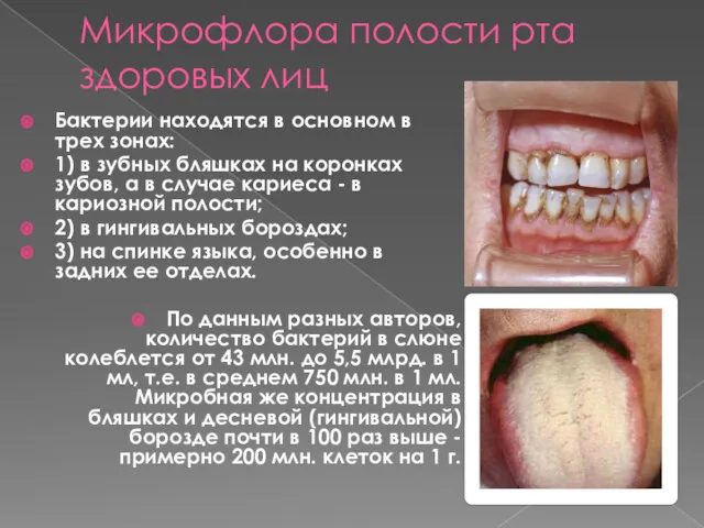 Микрофлора полости рта здоровых лиц Бактерии находятся в основном в