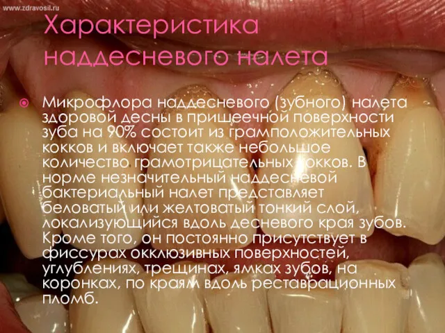 Характеристика наддесневого налета Микрофлора наддесневого (зубного) налета здоровой десны в