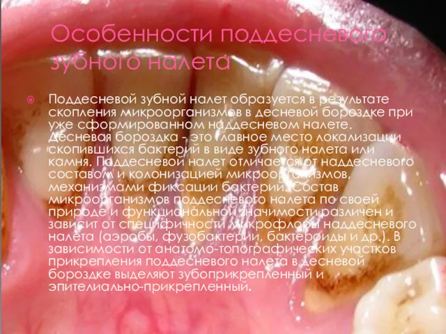 Особенности поддесневого зубного налета Поддесневой зубной налет образуется в результате