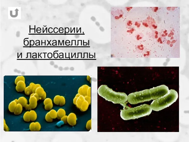 Нейссерии, бранхамеллы и лактобациллы