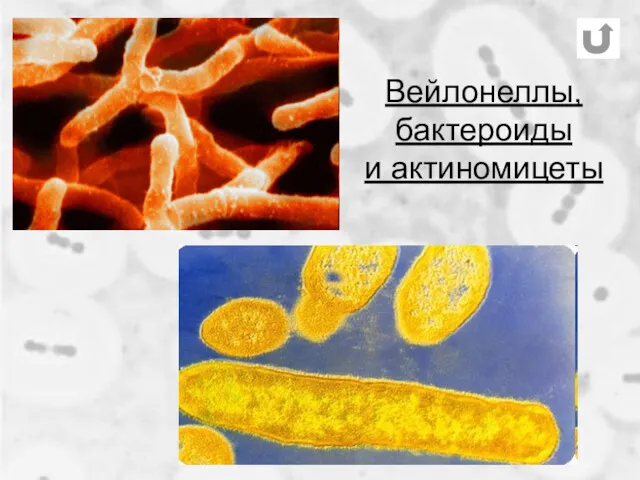 Вейлонеллы, бактероиды и актиномицеты