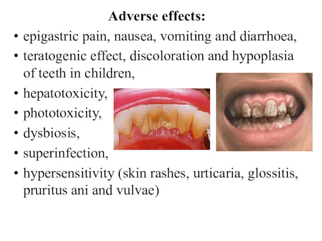 Adverse effects: epigastric pain, nausea, vomiting and diarrhoea, teratogenic effect,