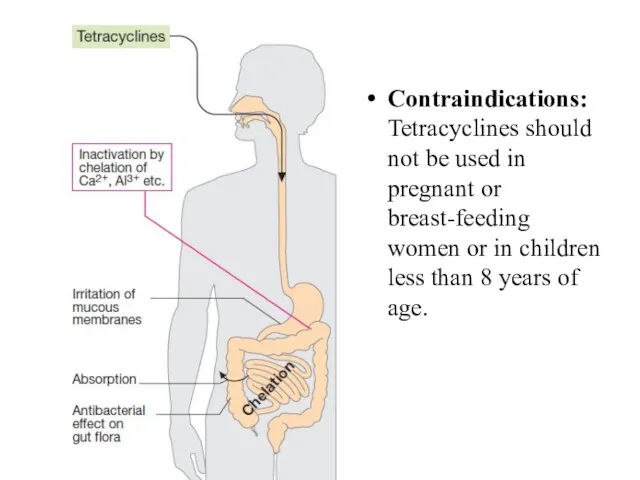 Contraindications: Tetracyclines should not be used in pregnant or breast-feeding