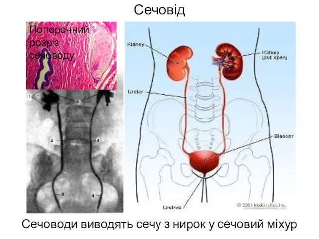 Сечовід Сечоводи виводять сечу з нирок у сечовий міхур Поперечний розріз сечоводу