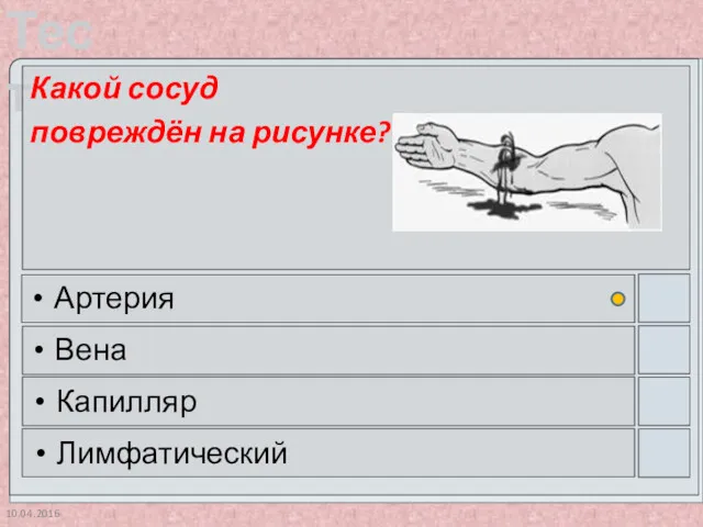 10.04.2016 Какой сосуд повреждён на рисунке? Артерия Вена Капилляр Лимфатический