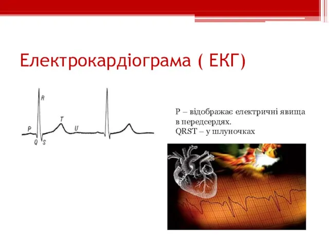 Електрокардіограма ( ЕКГ) Р – відображає електричні явища в передсердях. QRST – у шлуночках