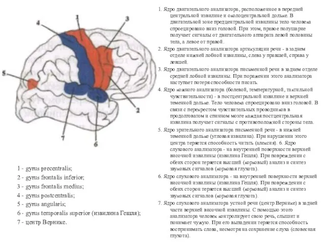 1 - gyrus precentralis; 2 - gyrus frontalis inferior; 3