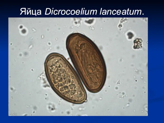 Яйца Dicrocoelium lanceatum.