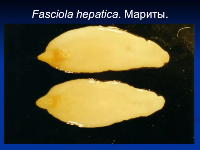 Fasciola hepatica. Мариты.
