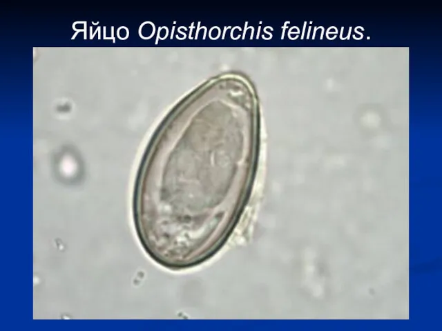 Яйцо Opisthorchis felineus.