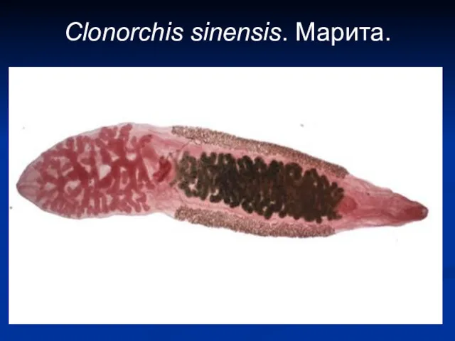 Clonorchis sinensis. Марита.