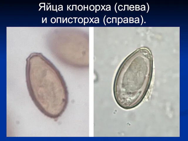 Яйца клонорха (слева) и описторха (справа).