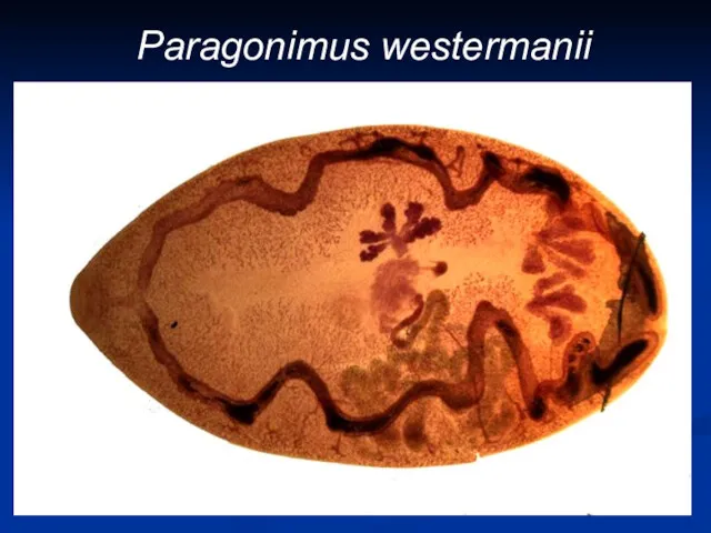 Paragonimus westermanii