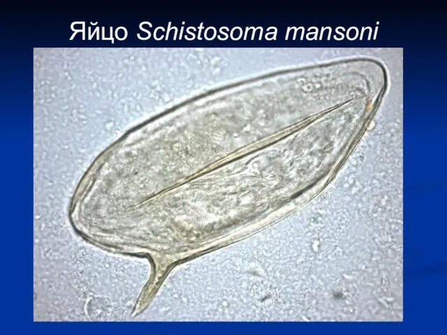 Яйцо Schistosoma mansoni