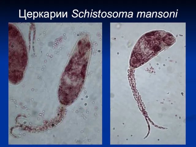 Церкарии Schistosoma mansoni