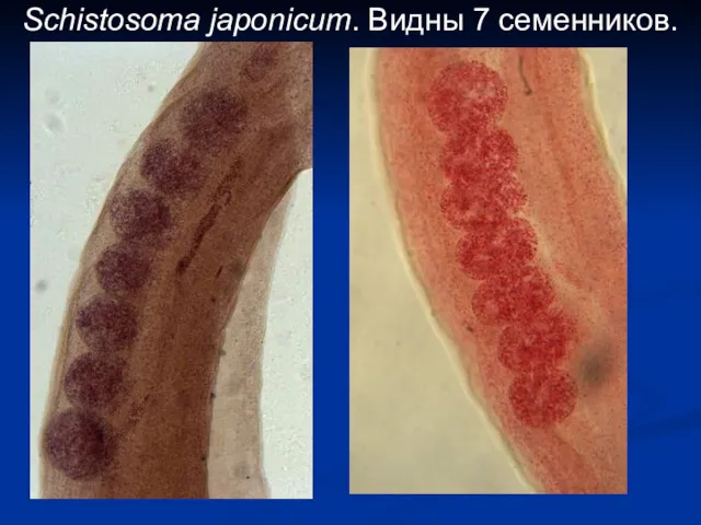 Schistosoma japonicum. Видны 7 семенников.