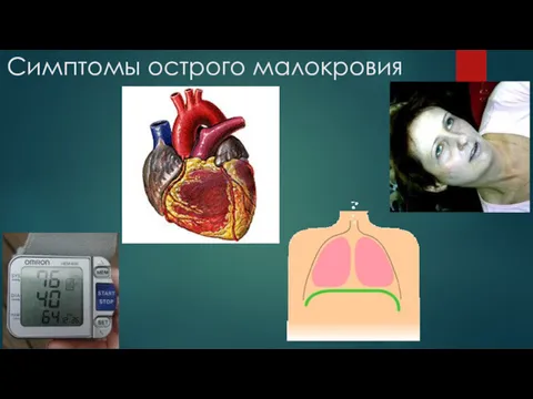 Симптомы острого малокровия