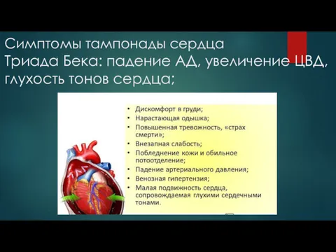 Симптомы тампонады сердца Триада Бека: падение АД, увеличение ЦВД, глухость тонов сердца;