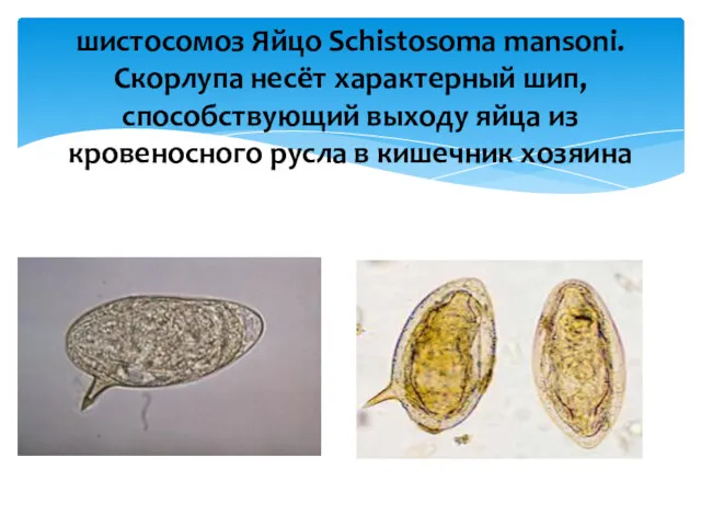 шистосомоз Яйцо Schistosoma mansoni. Скорлупа несёт характерный шип, способствующий выходу