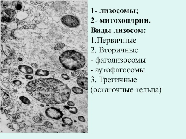 1- лизосомы; 2- митохондрии. Виды лизосом: 1.Первичные 2. Вторичные -