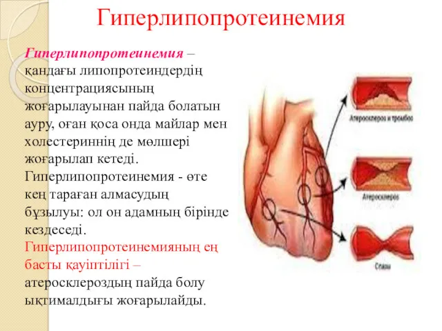 Гиперлипопротеинемия Гиперлипопротеинемия – қандағы липопротеиндердің концентрациясының жоғарылауынан пайда болатын ауру,