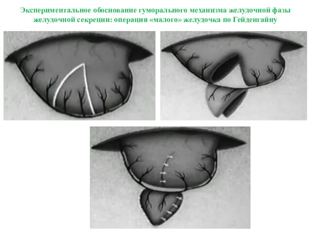 Экспериментальное обоснование гуморального механизма желудочной фазы желудочной секреции: операция «малого» желудочка по Гейденгайну