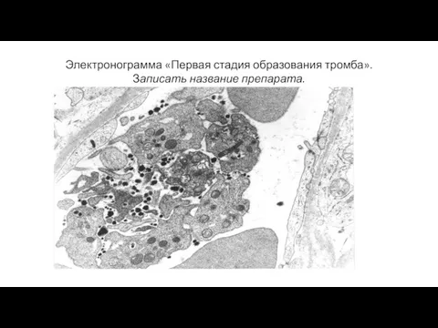 Электронограмма «Первая стадия образования тромба». Записать название препарата.