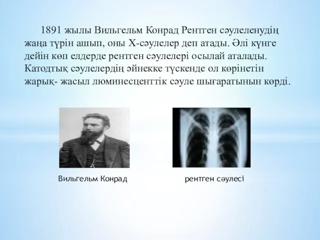 1891 жылы Вильгельм Конрад Рентген сәулеленудің жаңа түрін ашып, оны