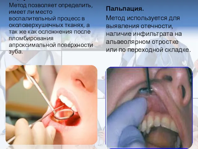 Перкуссия. Метод позволяет определить, имеет ли место воспалительный процесс в