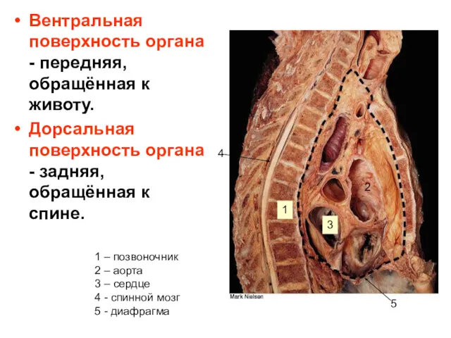 Вентральная поверхность органа - передняя, обращённая к животу. Дорсальная поверхность