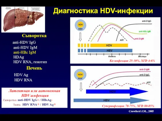 Диагностика HDV-инфекции Сыворотка anti-HDV IgG anti-HDV IgM anti-HBc IgM HDAg