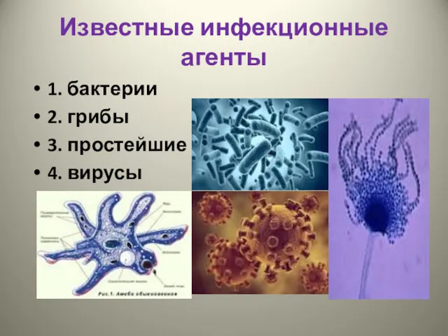 Известные инфекционные агенты 1. бактерии 2. грибы 3. простейшие 4. вирусы