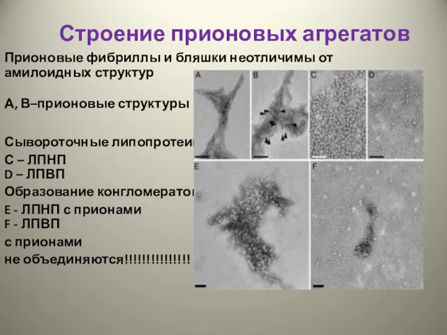 Строение прионовых агрегатов Прионовые фибриллы и бляшки неотличимы от амилоидных