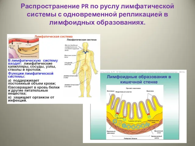 Распространение PR по руслу лимфатической системы с одновременной репликацией в лимфоидных образованиях.