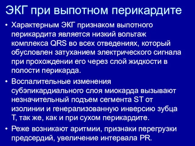 ЭКГ при выпотном перикардите Характерным ЭКГ признаком выпотного перикардита является низкий вольтаж комплекса