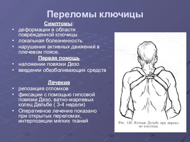 Переломы ключицы Симптомы: деформации в области поврежденной ключицы локальная болезненность