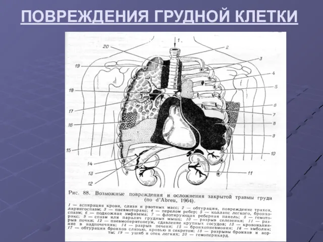 ПОВРЕЖДЕНИЯ ГРУДНОЙ КЛЕТКИ