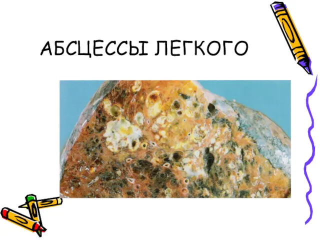 АБСЦЕССЫ ЛЕГКОГО