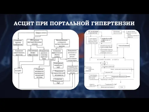 АСЦИТ ПРИ ПОРТАЛЬНОЙ ГИПЕРТЕНЗИИ