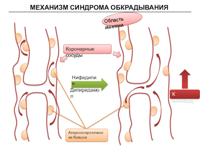 МЕХАНИЗМ СИНДРОМА ОБКРАДЫВАНИЯ Нифедипин Область ишемии Атеросклеротические бляшки Коронарные сосуды К миокарду Дипиридамол