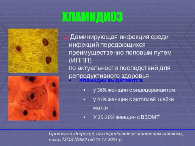 Доминирующая инфекция среди инфекций передающихся преимущественно половым путем (ИППП) по