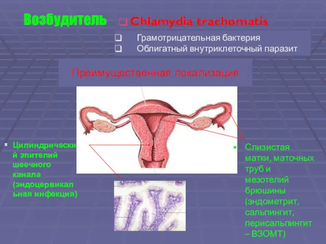 Цилиндрический эпителий шеечного канала (эндоцервикальная инфекция) Слизистая матки, маточных труб
