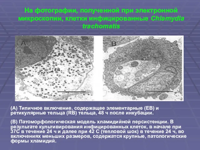 На фотографии, полученной при электронной микроскопии, клетки инфицированные Chlamydia trachomatis