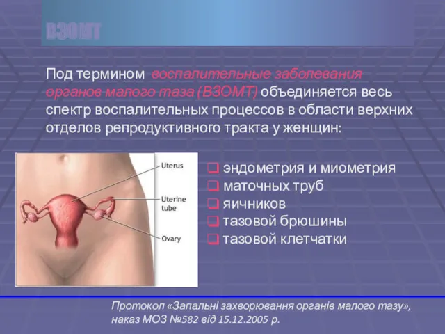 Под термином воспалительные заболевания органов малого таза (ВЗОМТ) объединяется весь