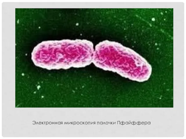 Электронная микроскопия палочки Пфайффера