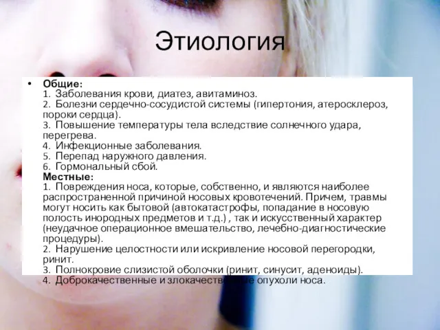 Этиология Общие: 1. Заболевания крови, диатез, авитаминоз. 2. Болезни сердечно-сосудистой системы (гипертония, атеросклероз,