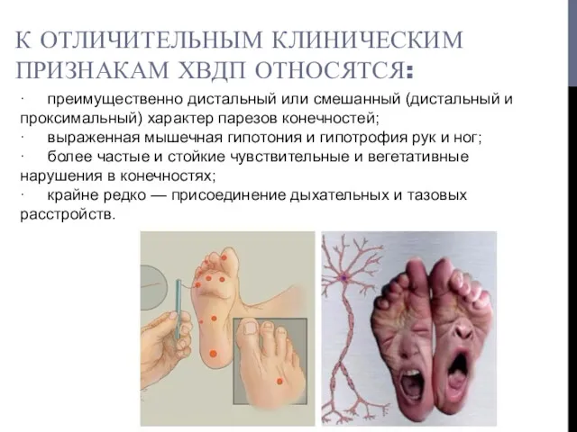 К ОТЛИЧИТЕЛЬНЫМ КЛИНИЧЕСКИМ ПРИЗНАКАМ ХВДП ОТНОСЯТСЯ: · преимущественно дистальный или