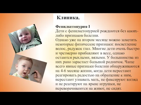 Фенилкетонурия I Дети с фенилкетонурией рождаются без каких-либо признаков болезни.