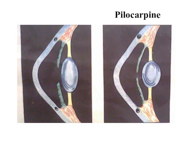 Pilocarpine