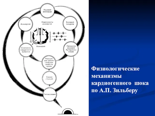 Физиологические механизмы кардиогенного шока по А.П. Зильберу